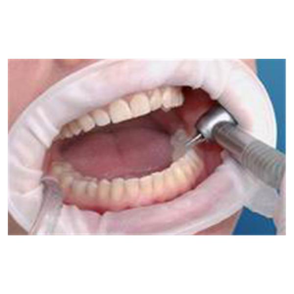 Ivoclar Vivadent 577275 OptraGate 3D Lip & Cheek Retractor Assortment 80/Bx Ivoclar Vivadent 577275 OptraGate 3D Lip & Cheek Retractor Assortment 80/Bx